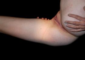 The latest pictures of my cute girl and her shaved hole made somewhere outdoors at night. Image 4