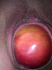 Difference between 4 cucumbers and a fist
