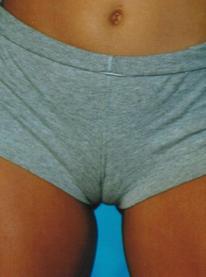 cameltoe girls