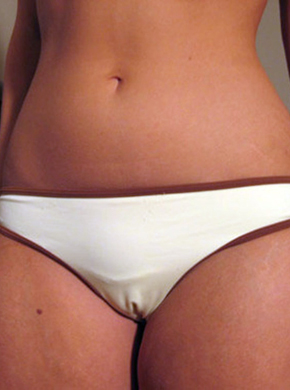 cameltoe girls