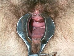 #1 Amateur Fisting Picture Sample
