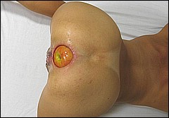 #6 Amateur Fisting Picture Sample