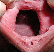 #5 Amateur Fisting Picture Sample