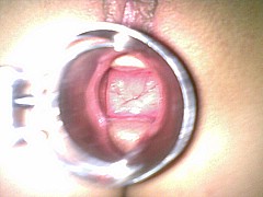 #5 Amateur Fisting Picture Sample
