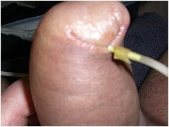 #3 Urethral Play Sample