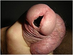#4 Urethral Play Sample