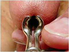 #5 Urethral Play Sample