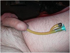 #2 Urethral Play Sample