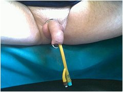 #5 Urethral Play Sample
