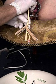 speculum01.jpg