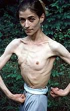 anorexic15.jpg