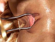 speculum55.jpg