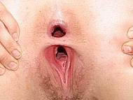 analgape03.jpg