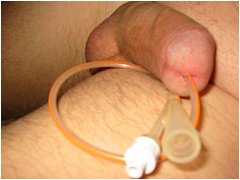 #6 Urethral Play Sample