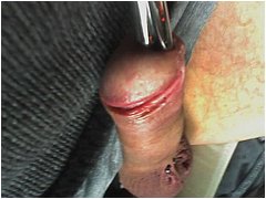 #6 Urethral Play Sample