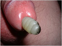 #3 Urethral Play Sample