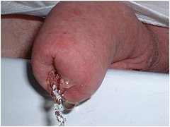 #4 Urethral Play Sample