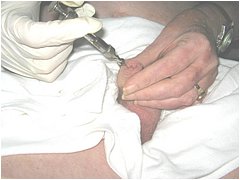 #4 Urethral Play Sample